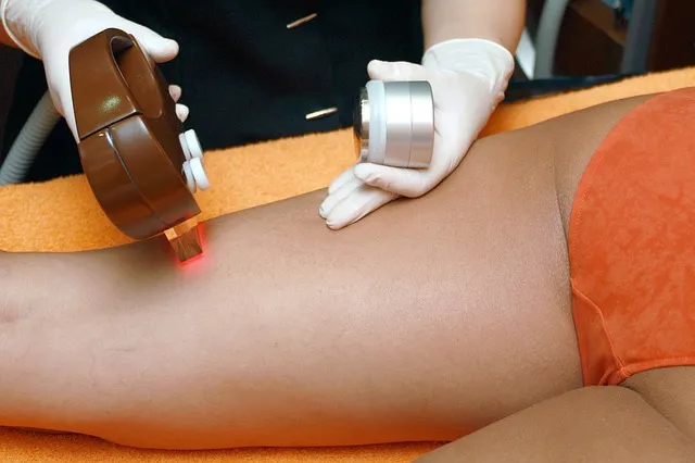 Laser na niechciane włoski. Co warto wiedzieć o depilacji laserowej?